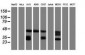 CD20 Antibody (clone 4B4)